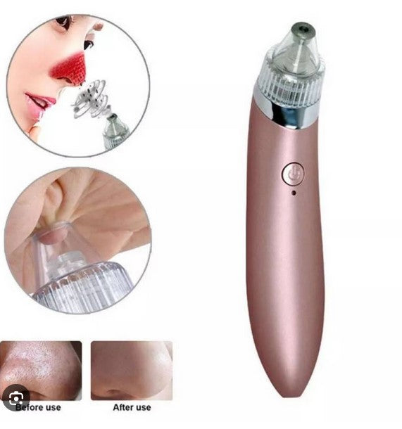Extractor de Puntos Negros y Espinillas - Florecer Cosmética
